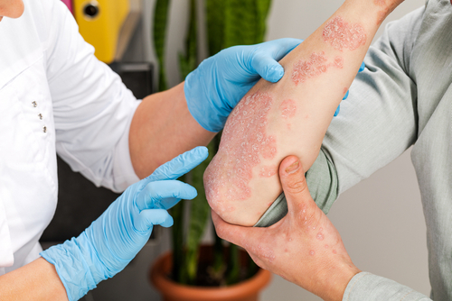 10 tips voor een geslaagde consultatie bij de dermatoloog 